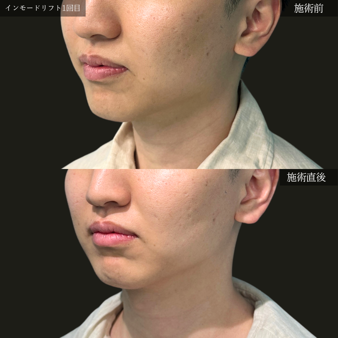 No.1077の症例写真