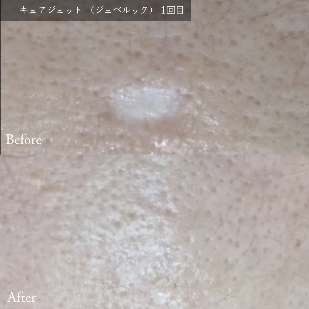 No.1733の症例写真