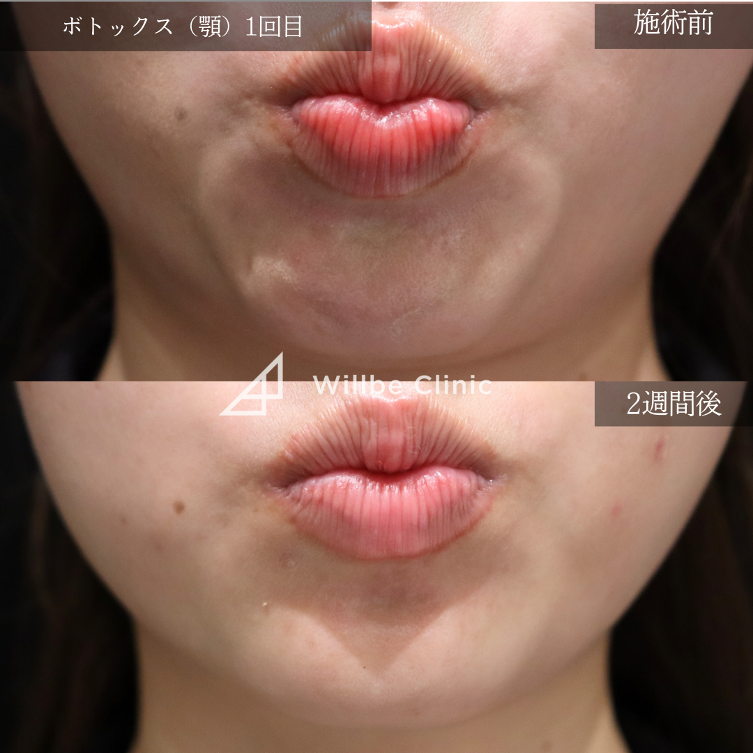 No.1604の症例写真