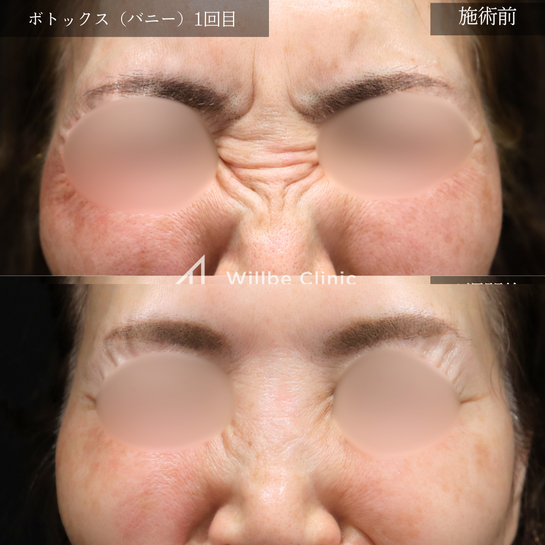 No.1607の症例写真