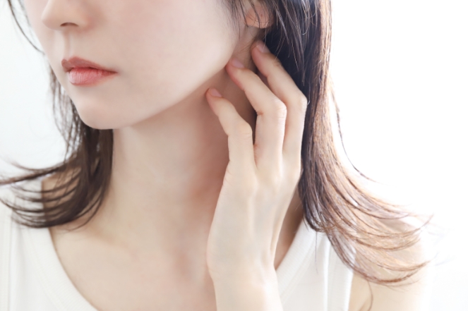 糸リフト(スレッドリフト)