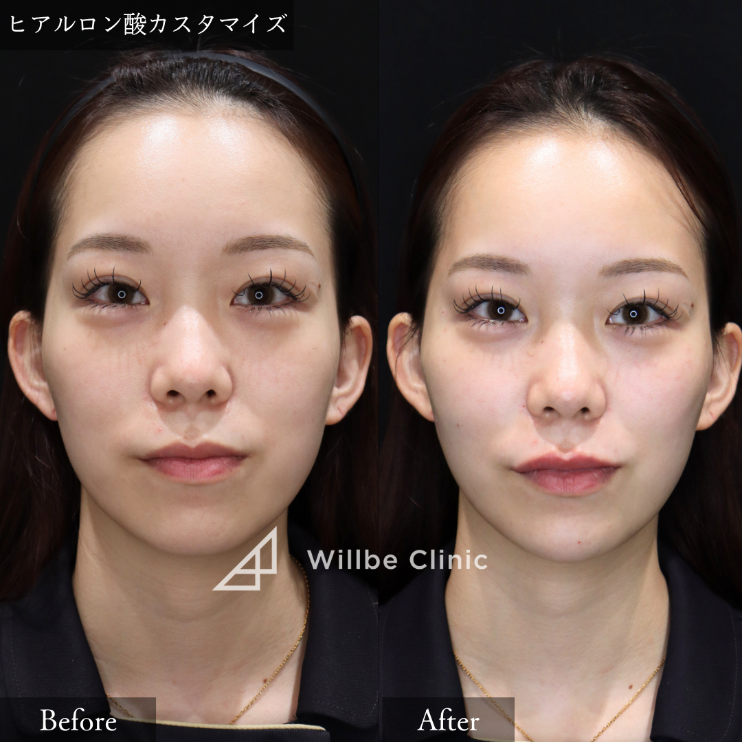 No.2612の症例写真