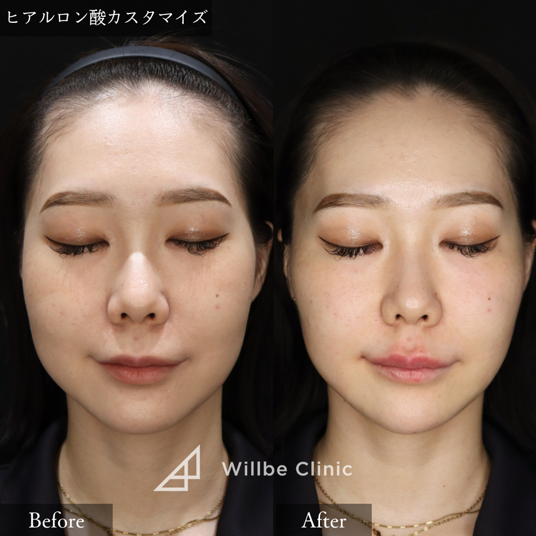 No.2609の症例写真