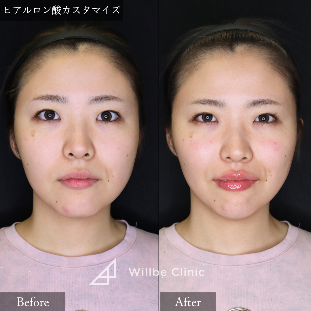 No.2606の症例写真