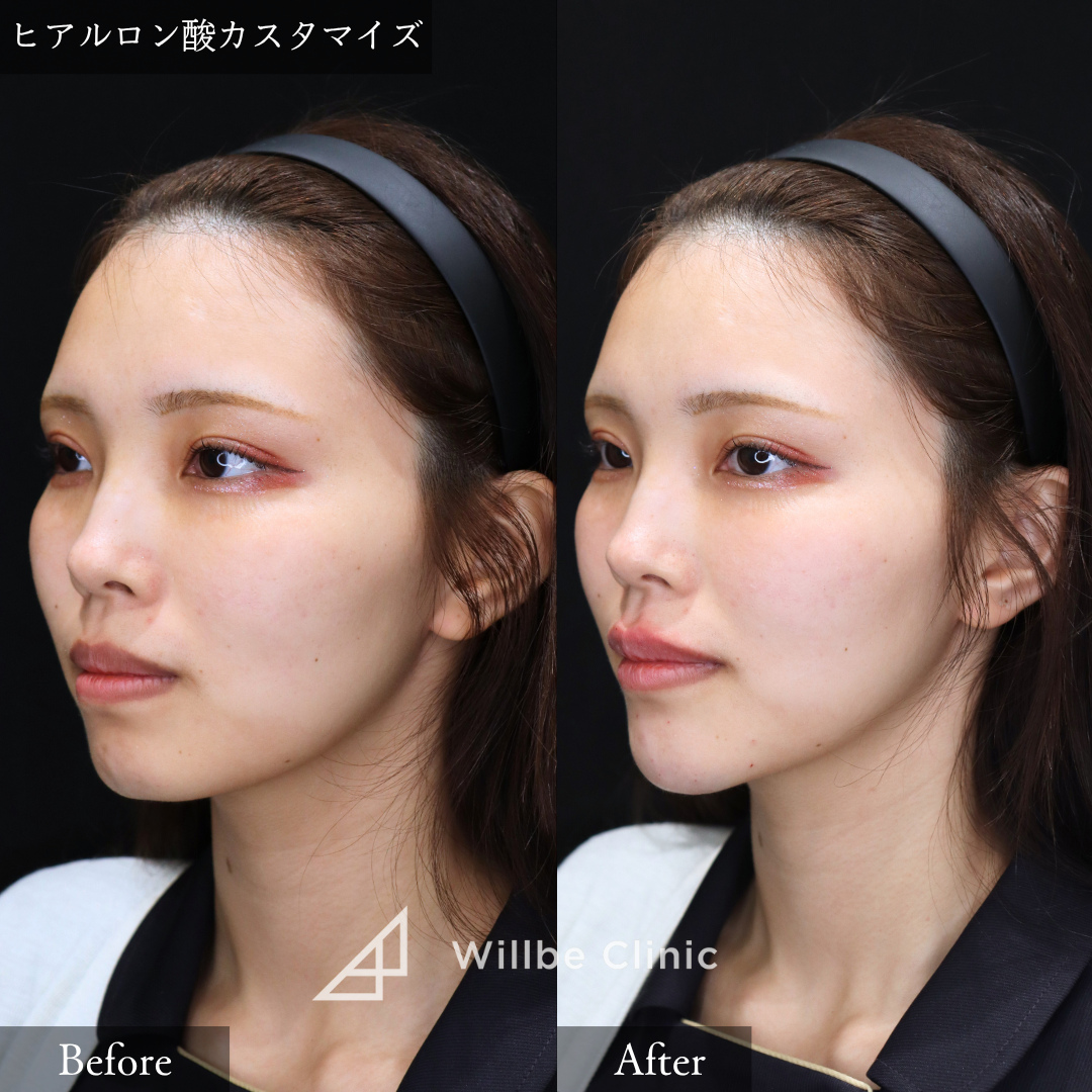 No.2603の症例写真