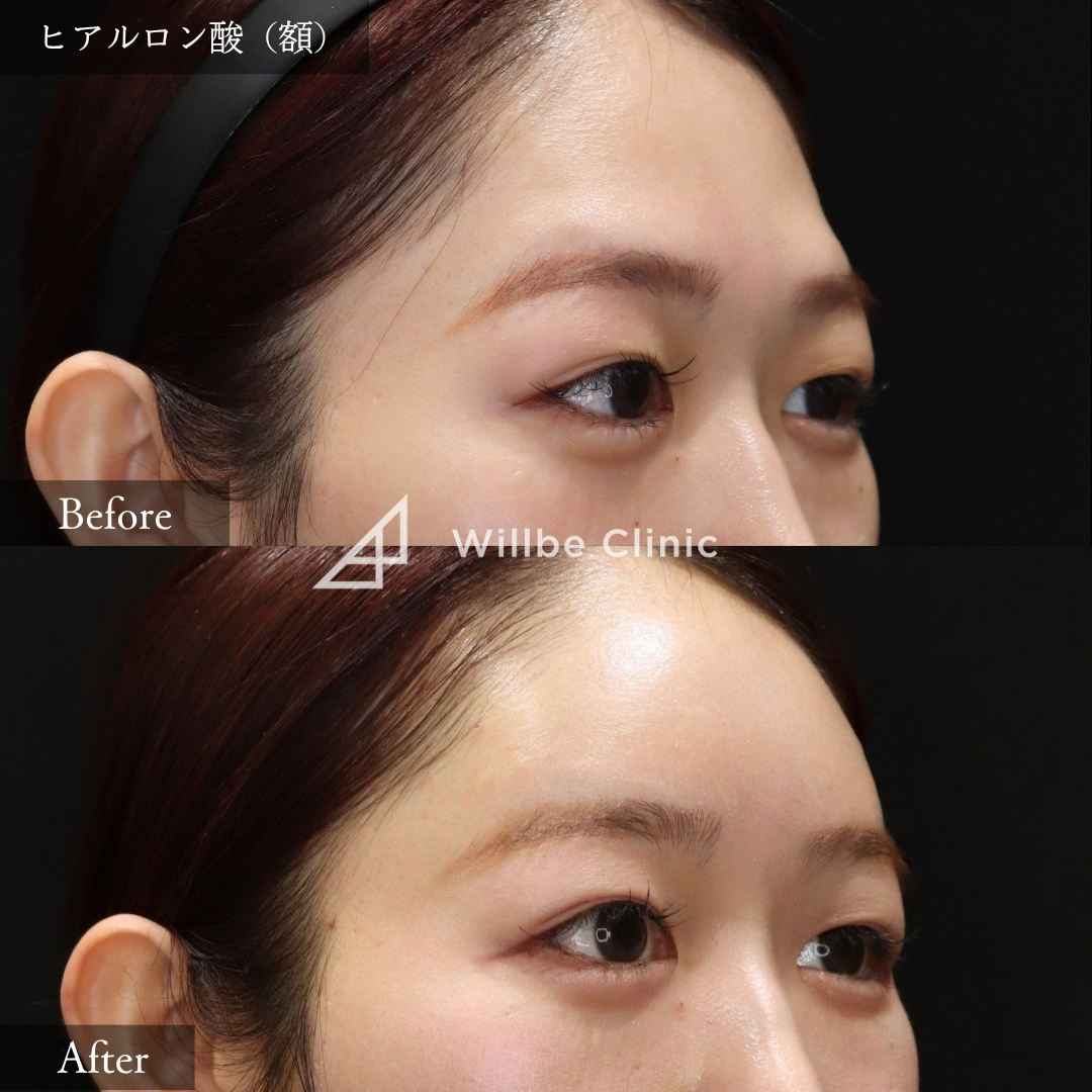 No.2595の症例写真