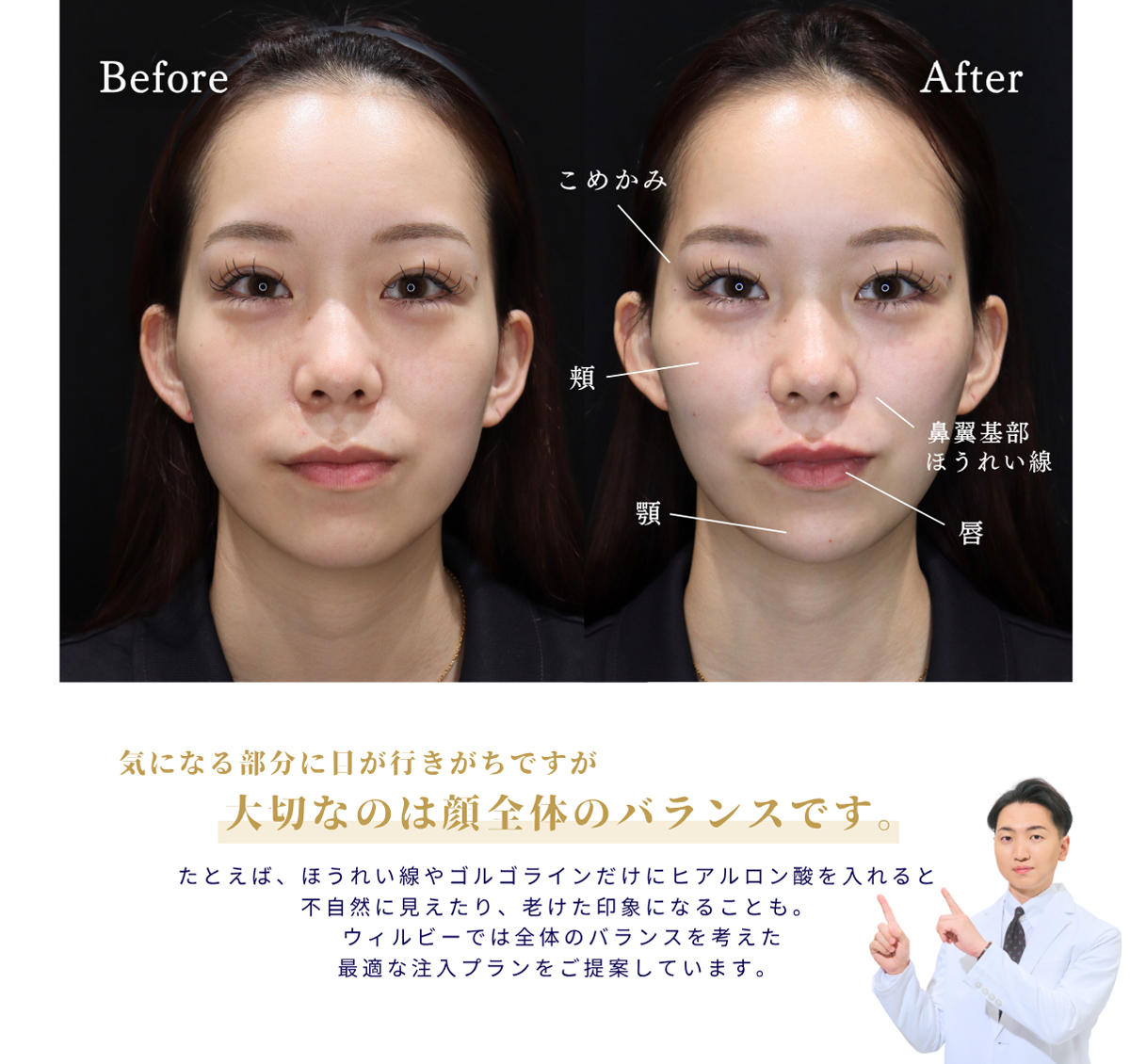 大切なのは顔全体のバランス 大切なのは顔全体のバランス