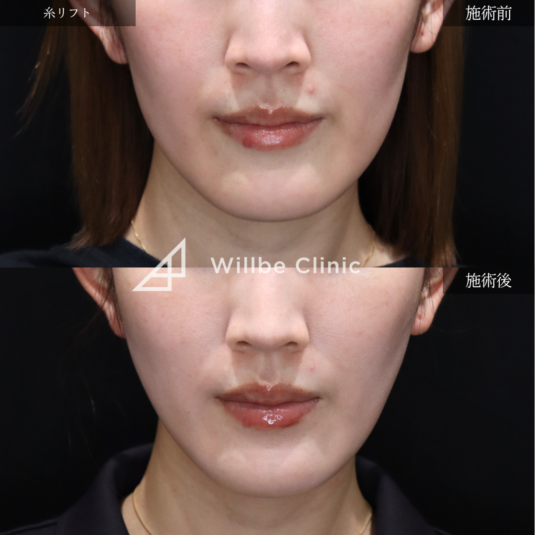 No.3609の症例写真