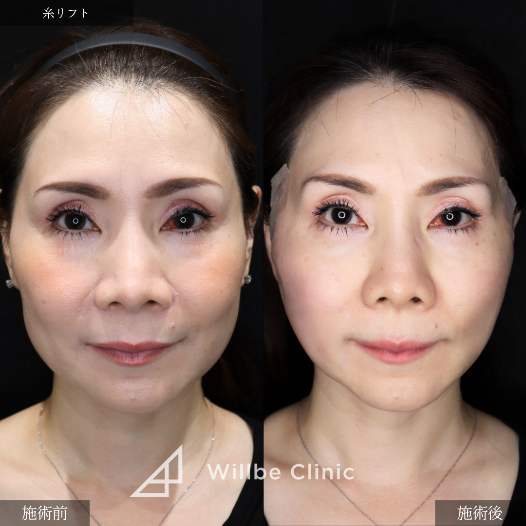 No.3602の症例写真