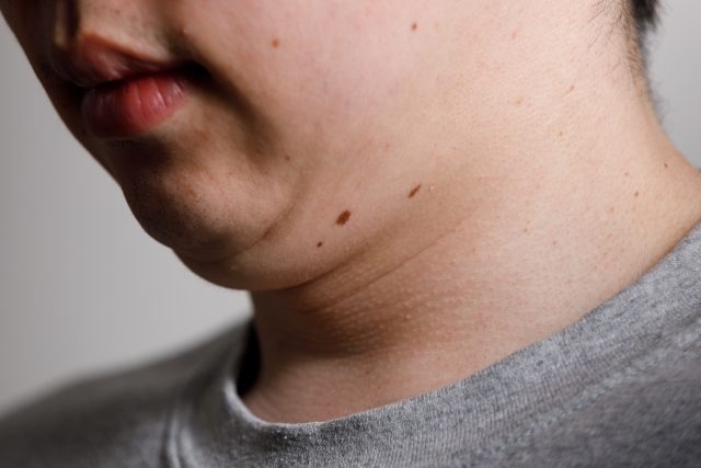 二重顎の原因を徹底解説｜セルフチェックリストや二重顎を解消する方法なども紹介