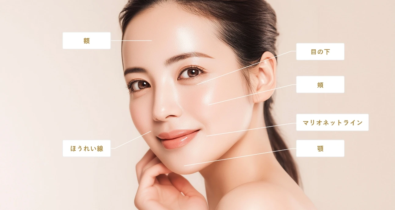 額・目の下・頬・ほうれい線・マリオネットライン・顎 額・目の下・頬・ほうれい線・マリオネットライン・顎