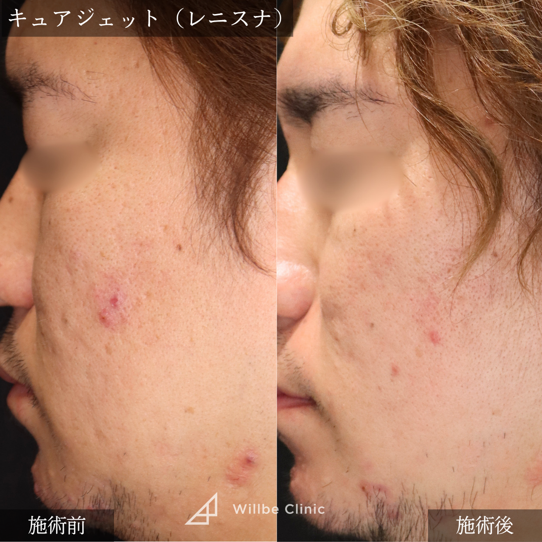 No.5380の症例写真