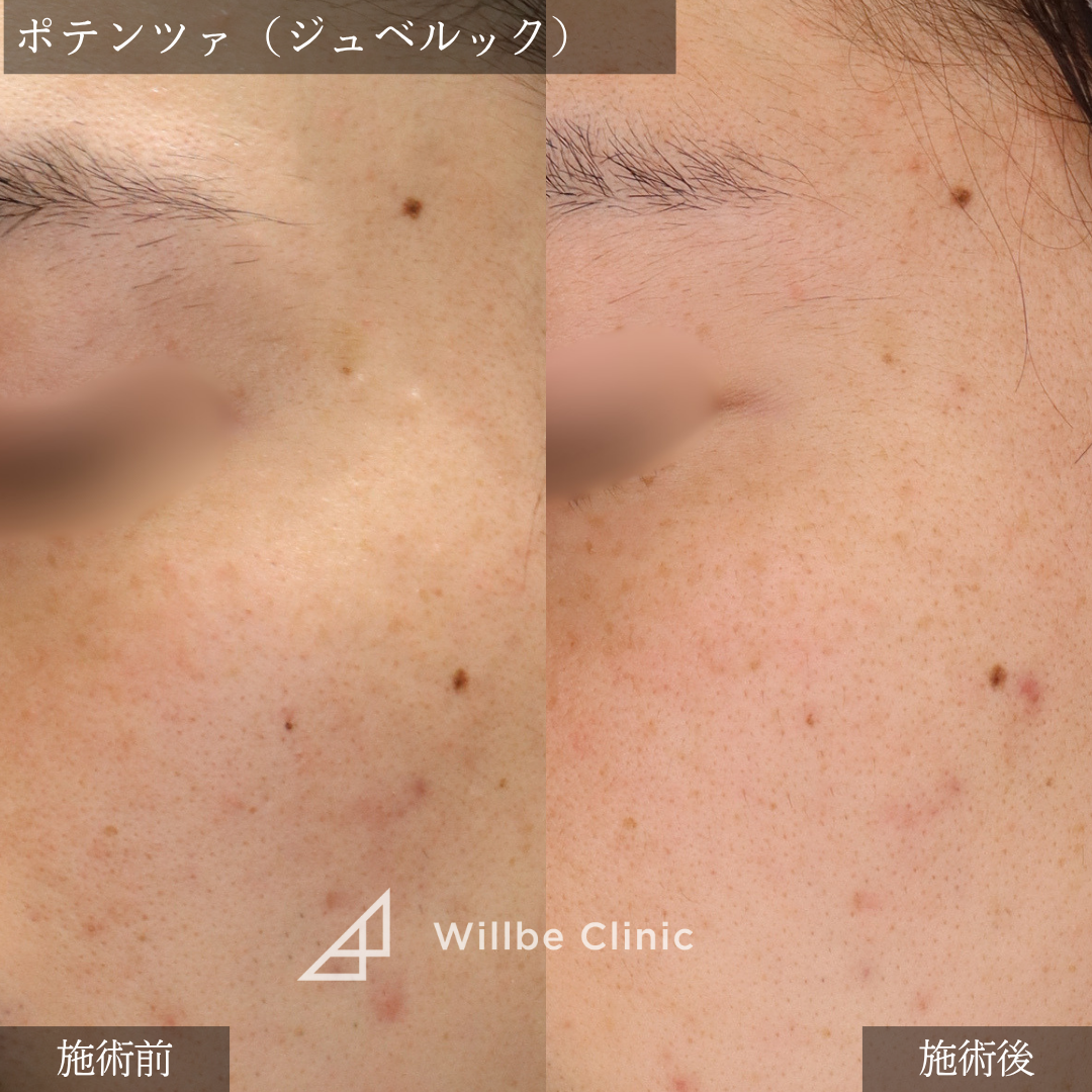 No.5426の症例写真