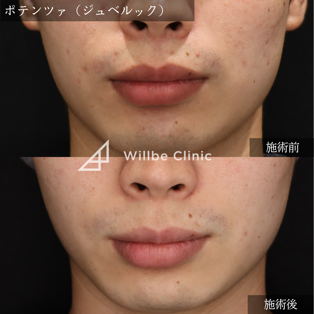 No.5405の症例写真