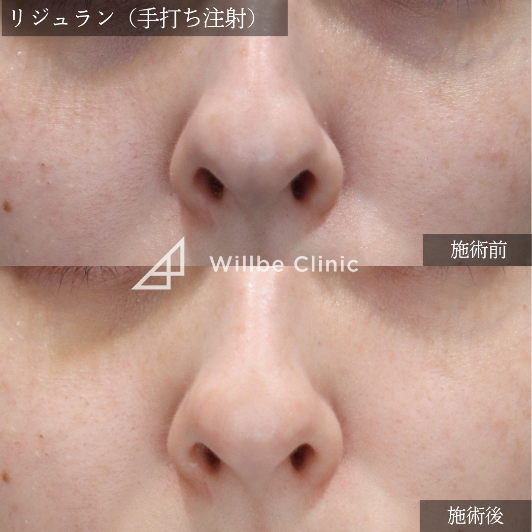 No.5432の症例写真