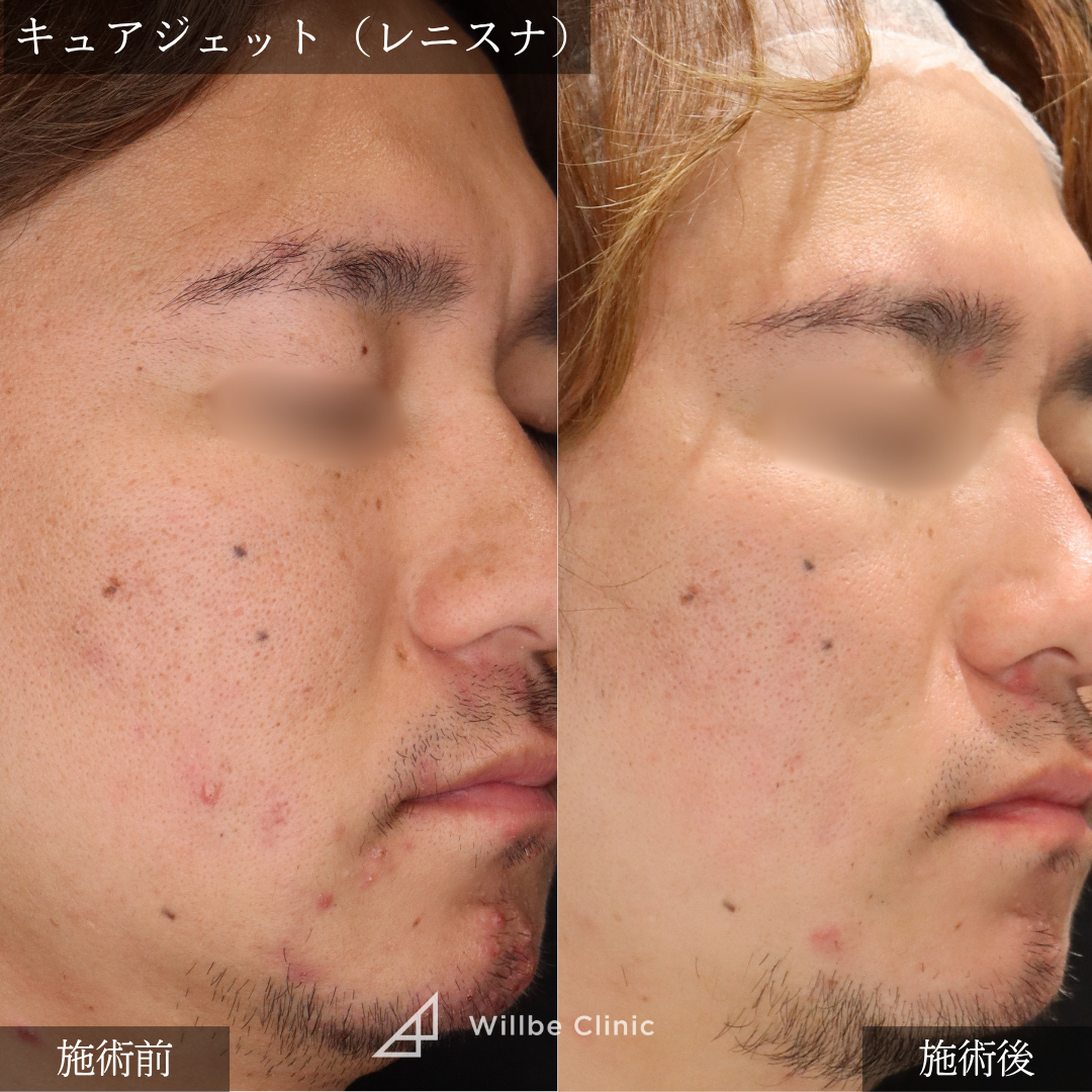 No.5388の症例写真