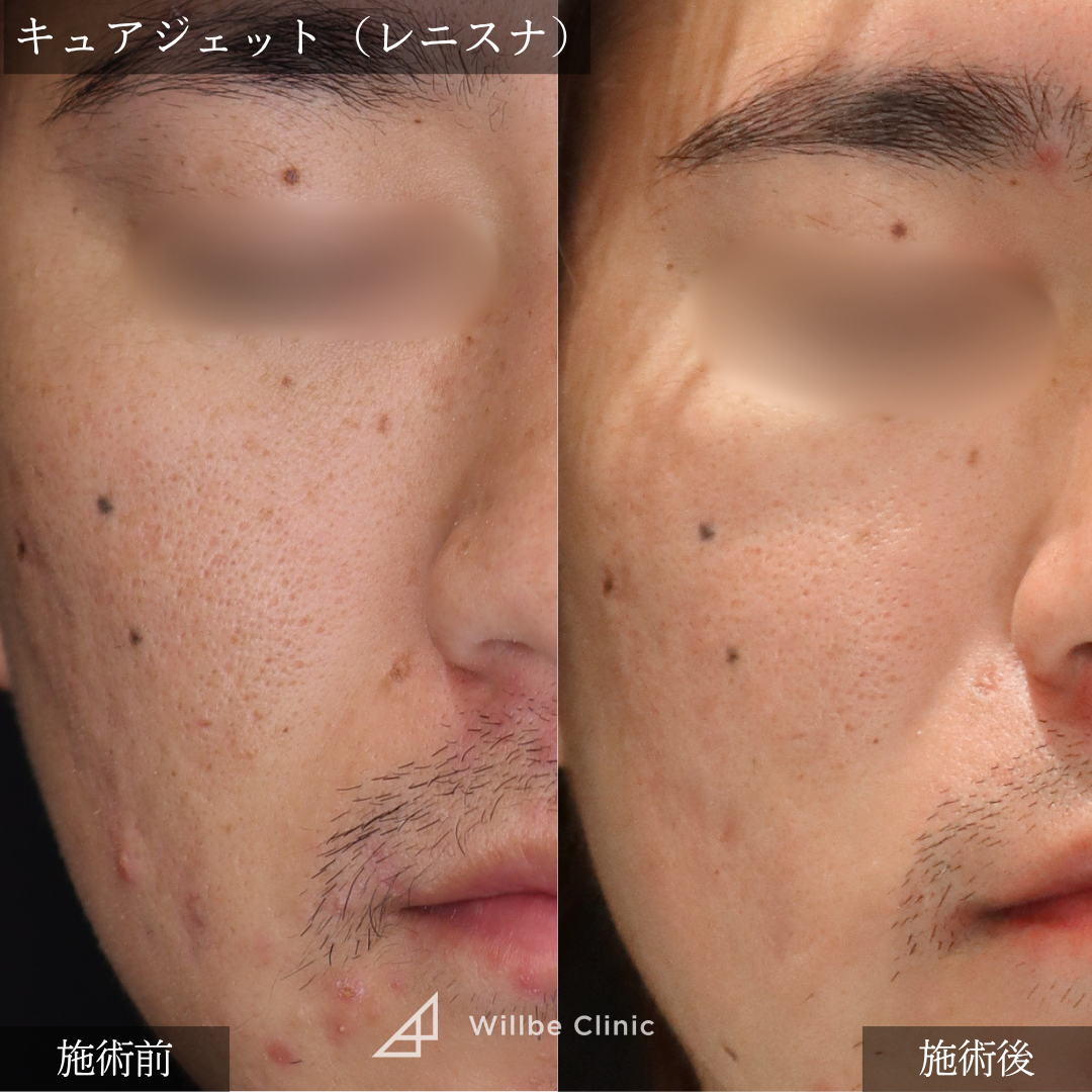 No.5391の症例写真