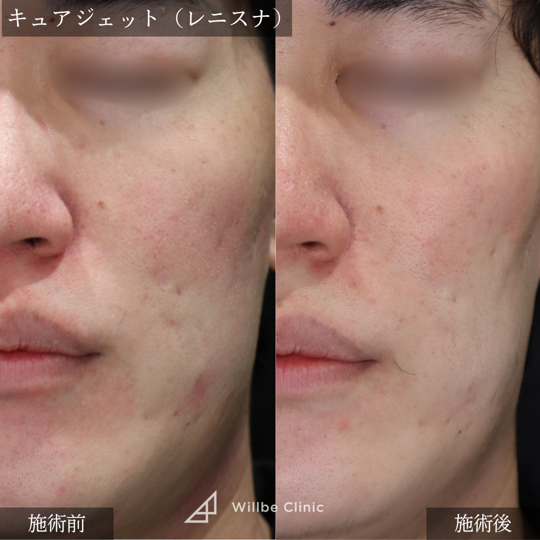 No.5620の症例写真 No.5620の症例写真