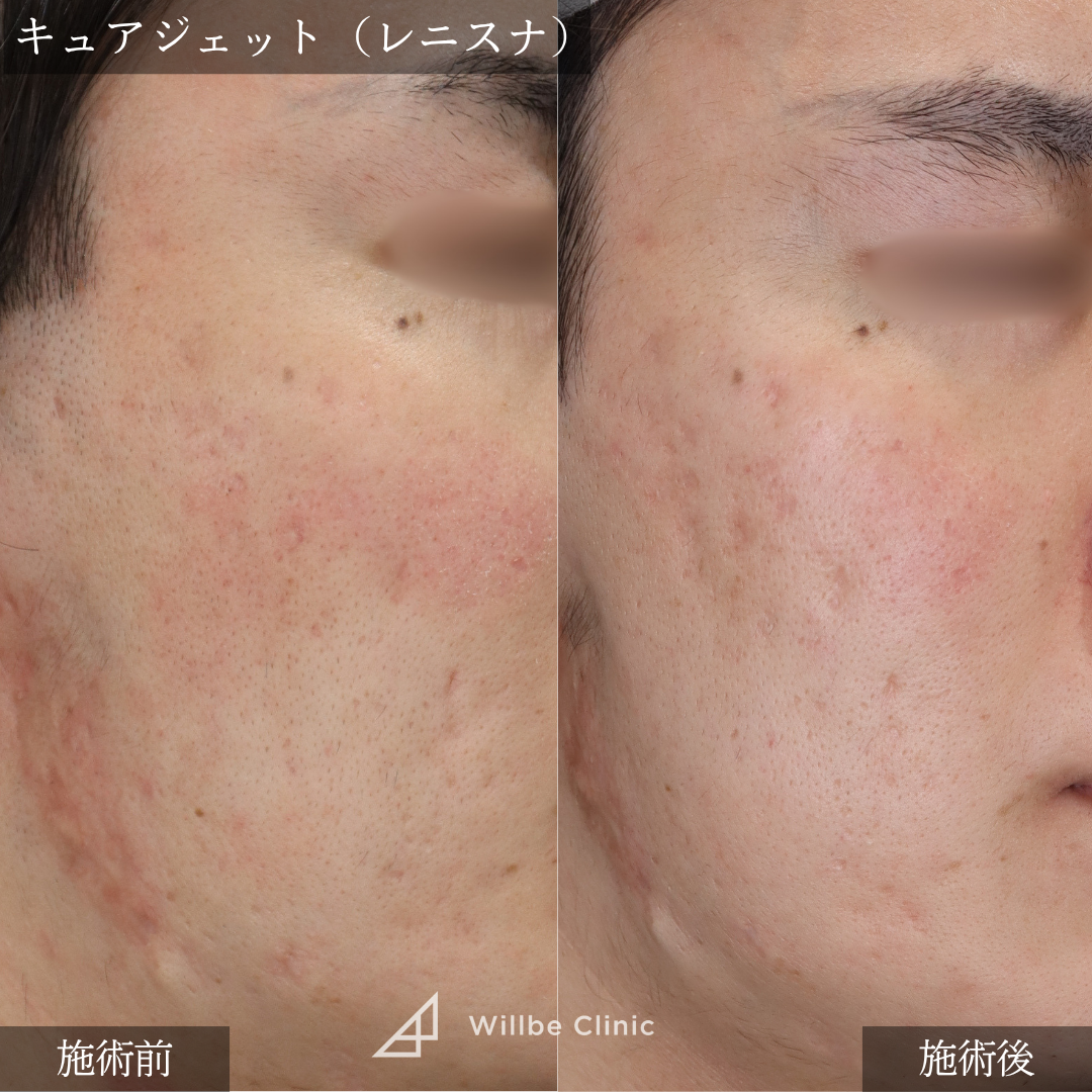No.5622の症例写真 No.5622の症例写真