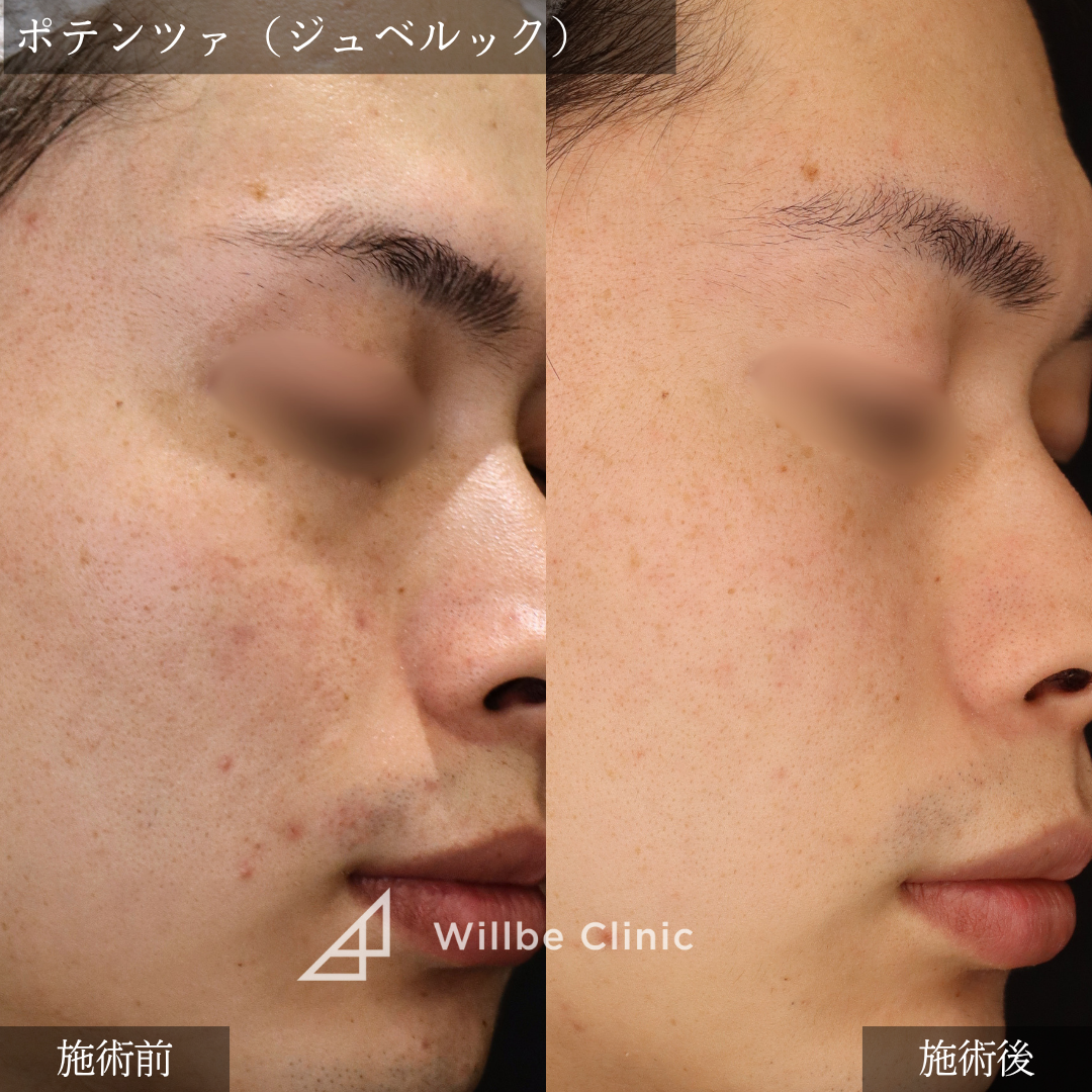 No.5420の症例写真