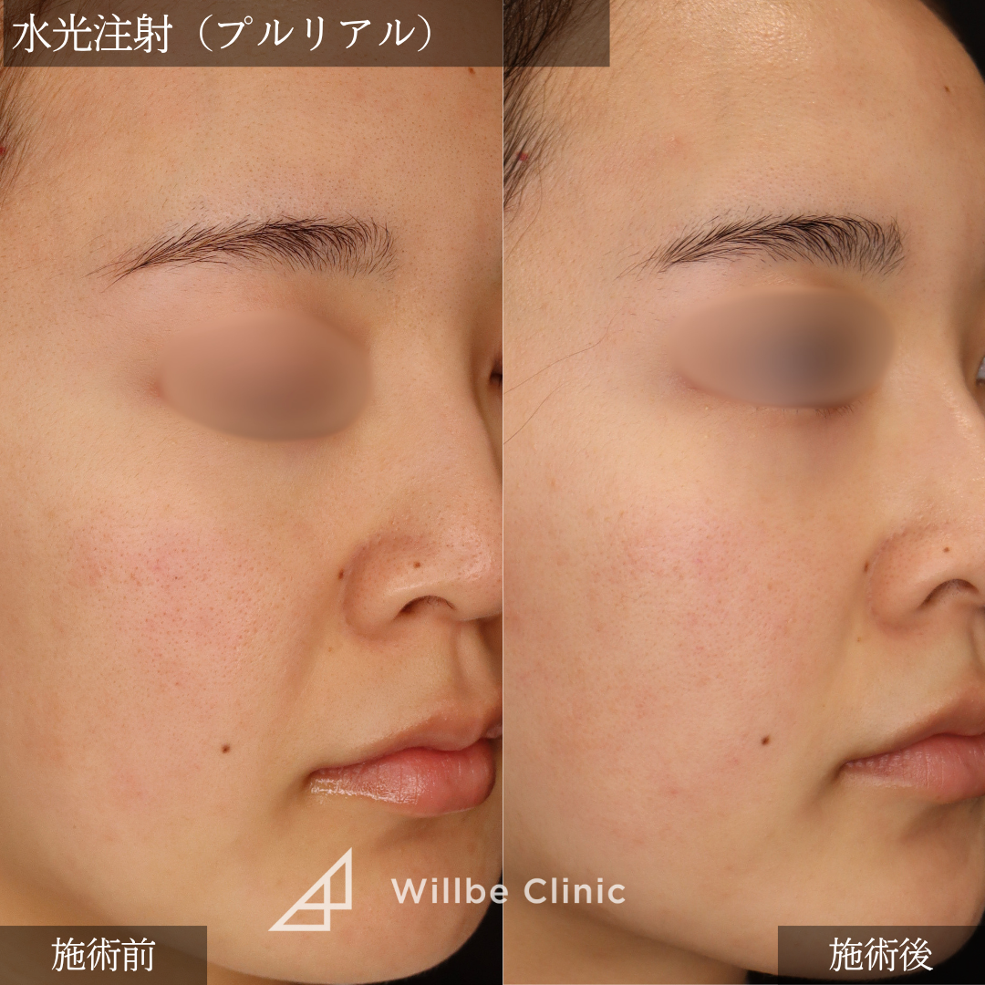 No.5429の症例写真