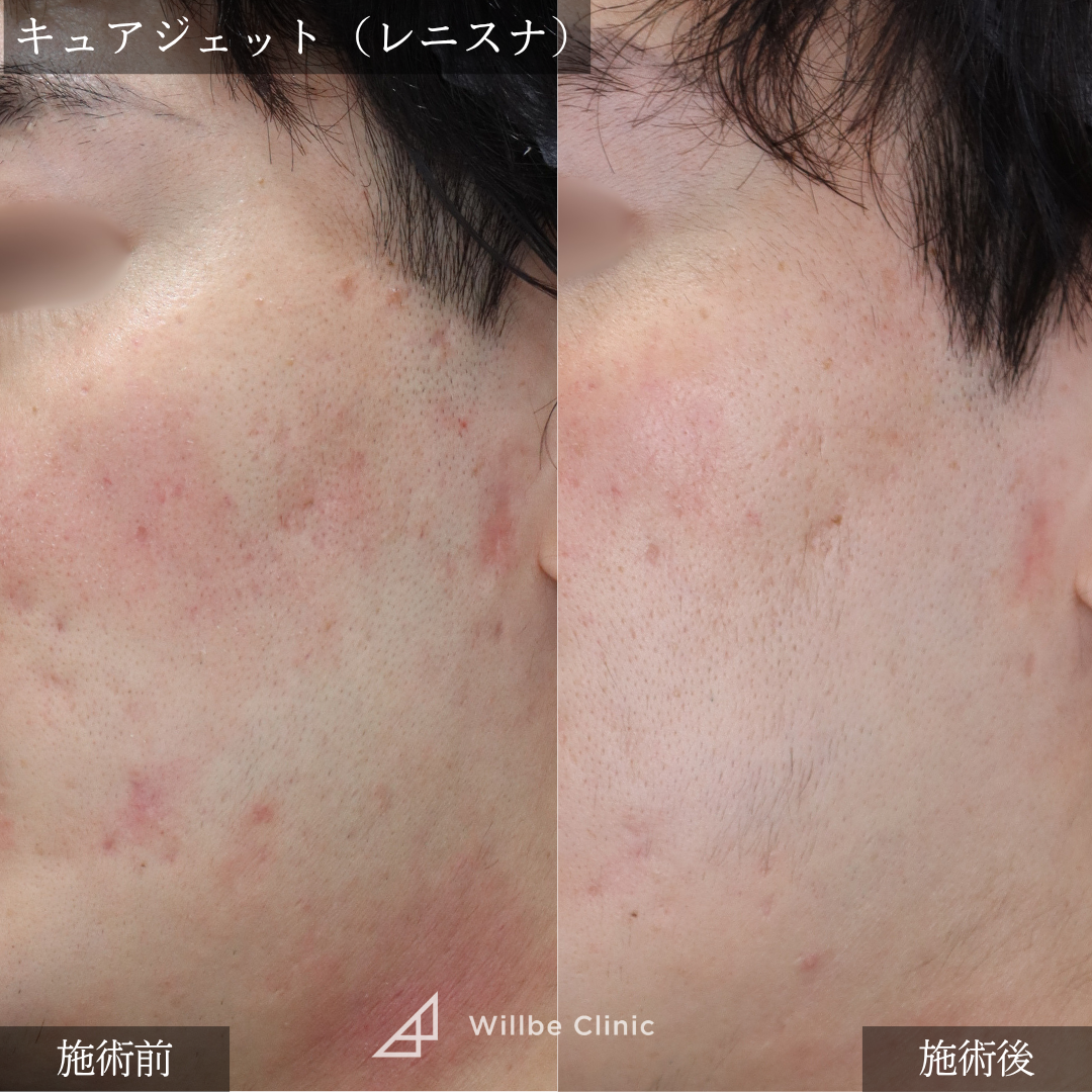 No.5624の症例写真 No.5624の症例写真
