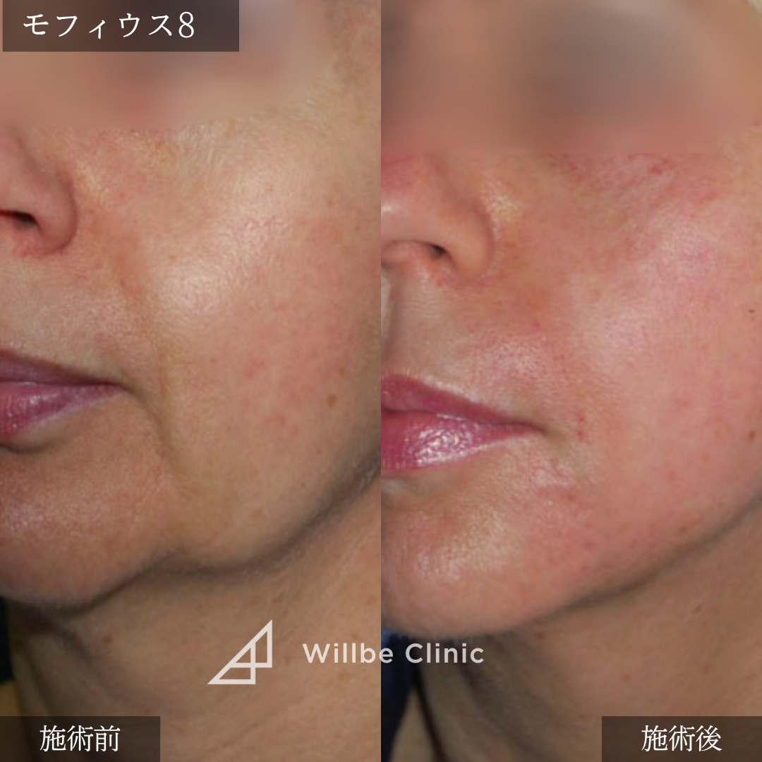 No.5600の症例写真 No.5600の症例写真