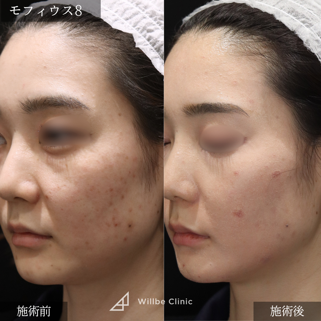 No.5613の症例写真 No.5613の症例写真