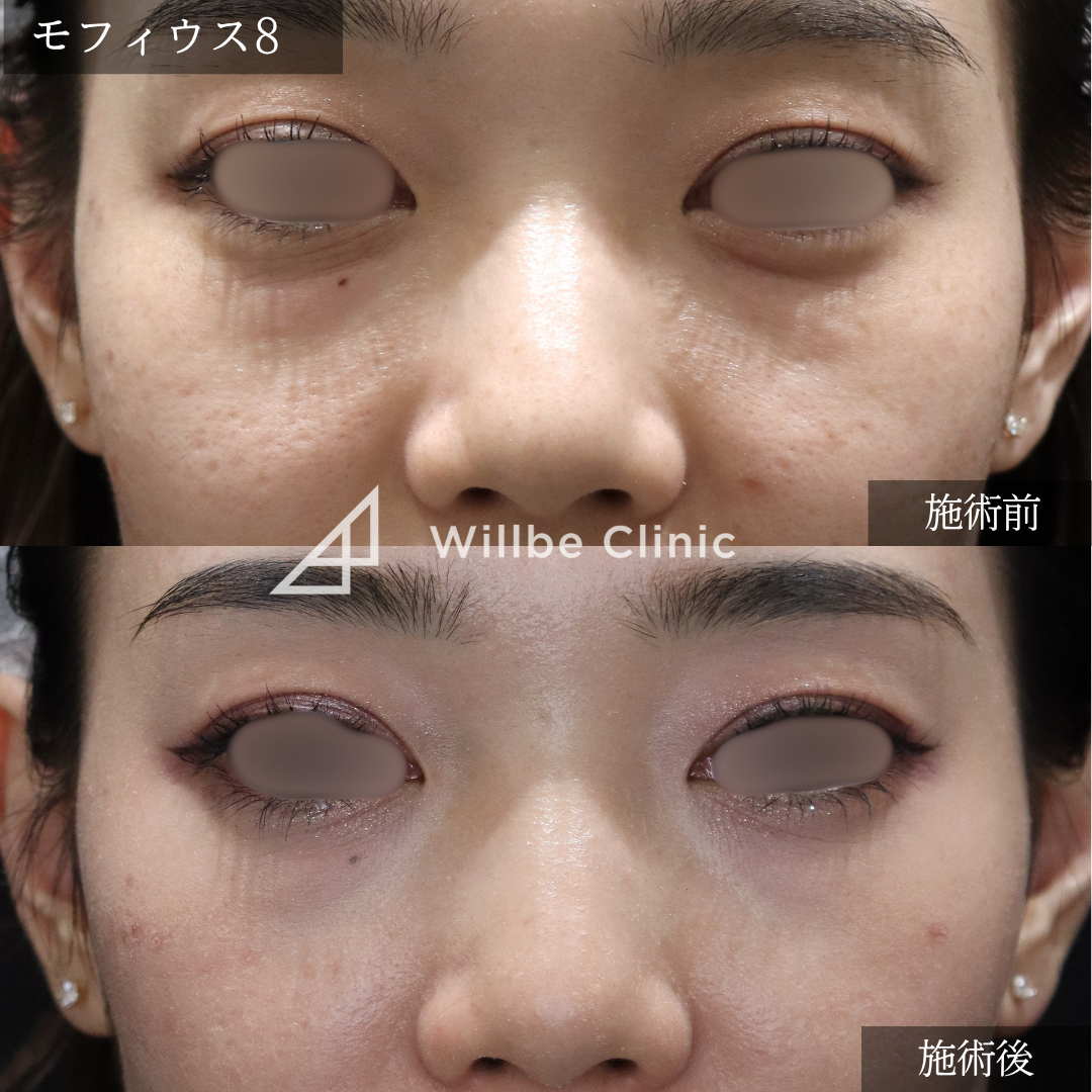 No.5610の症例写真 No.5610の症例写真