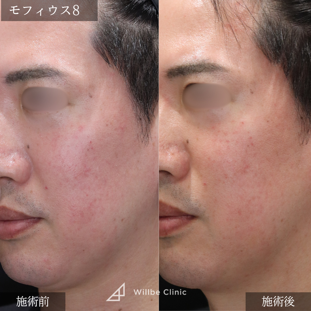 No.5616の症例写真 No.5616の症例写真