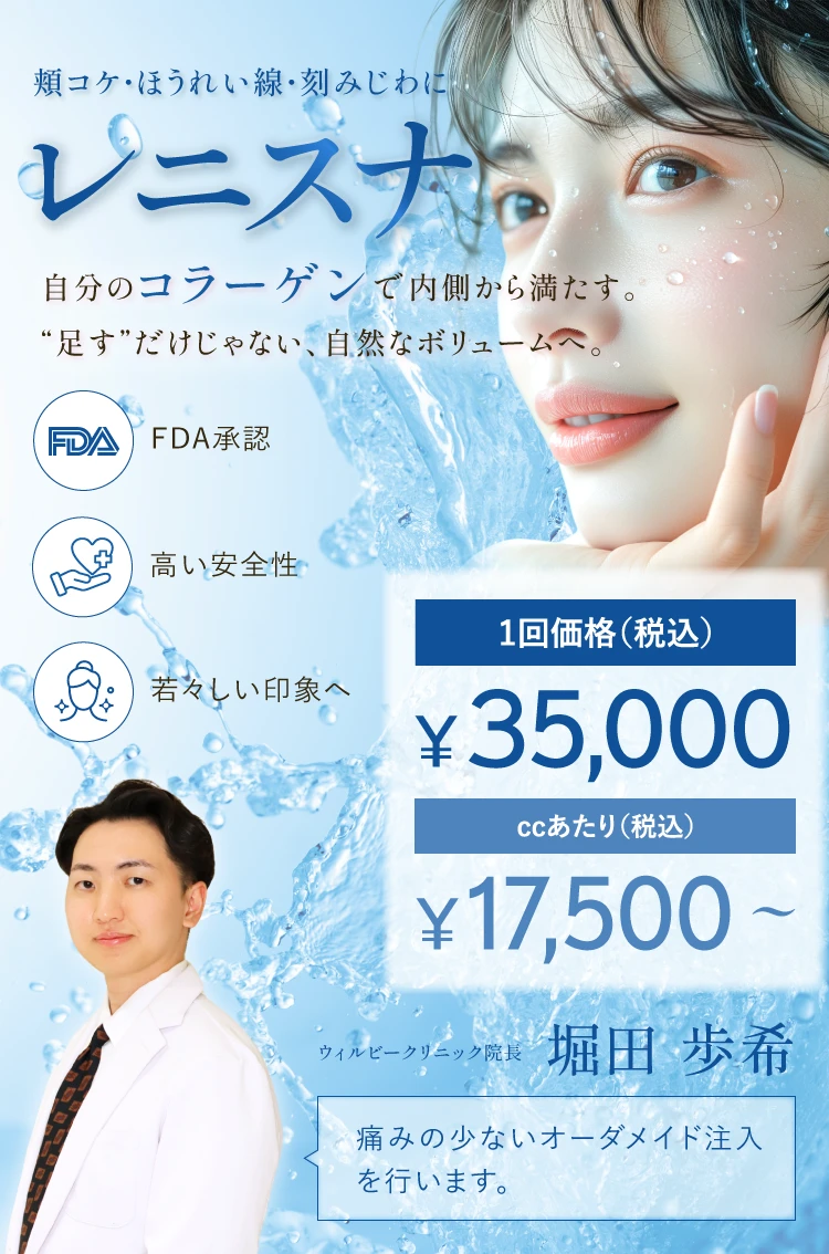 レニスナ