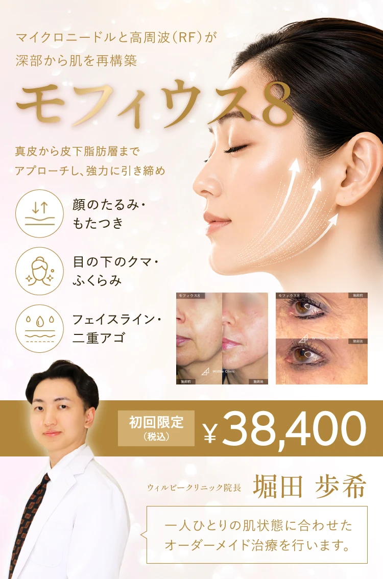 モフィウス