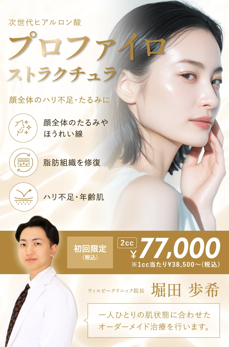 プロファイロ