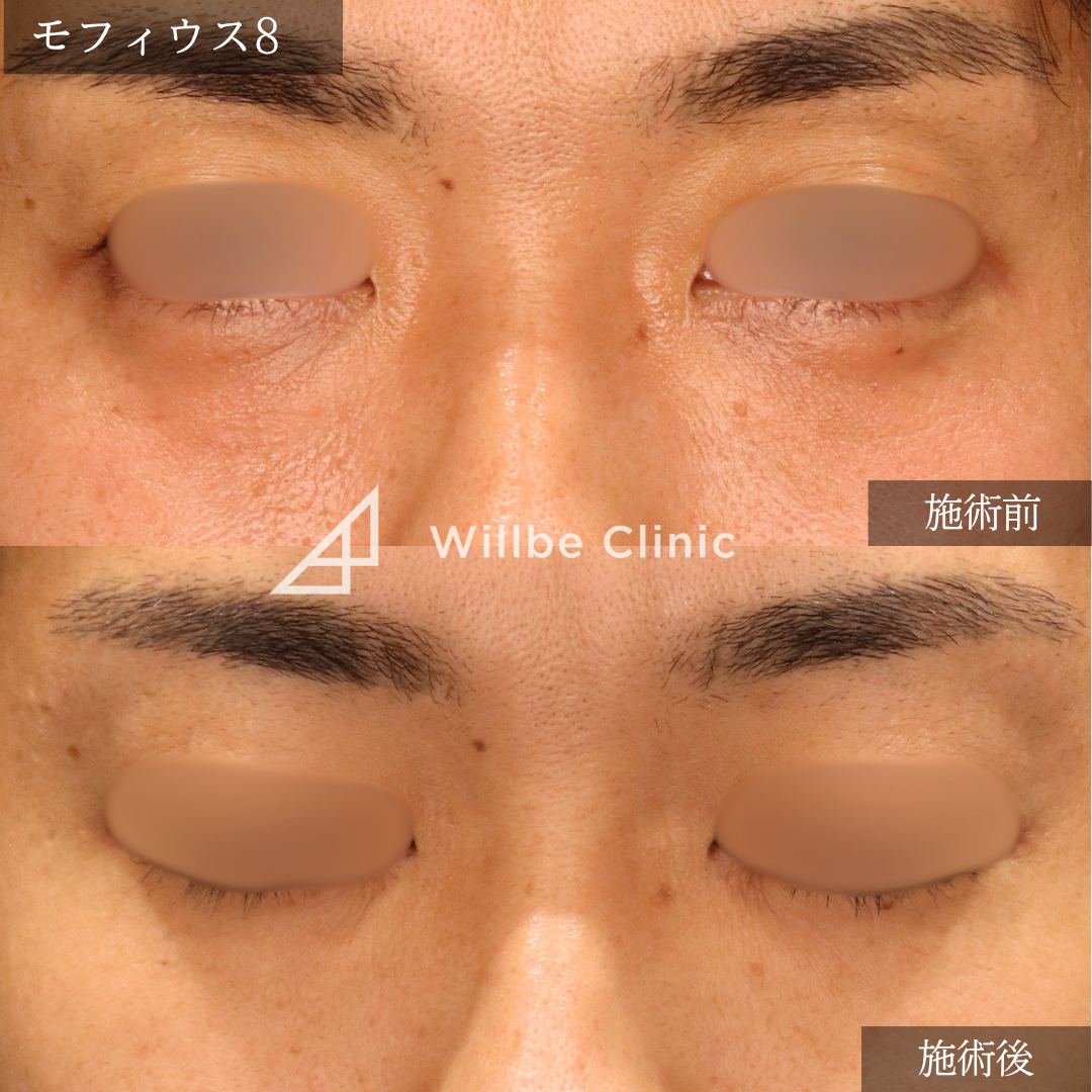 No.6762の症例写真 No.6762の症例写真