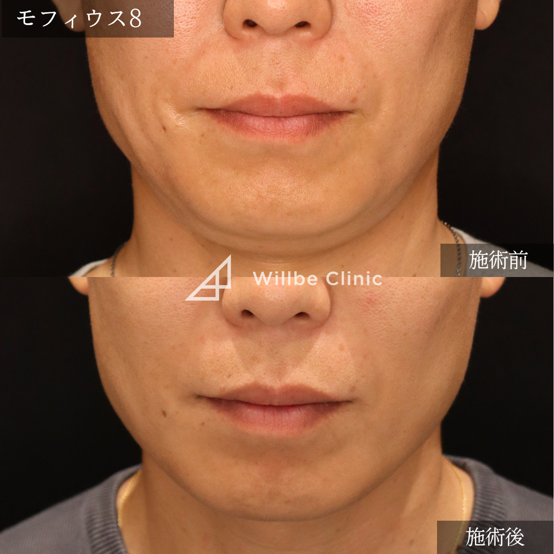 No.6766の症例写真 No.6766の症例写真