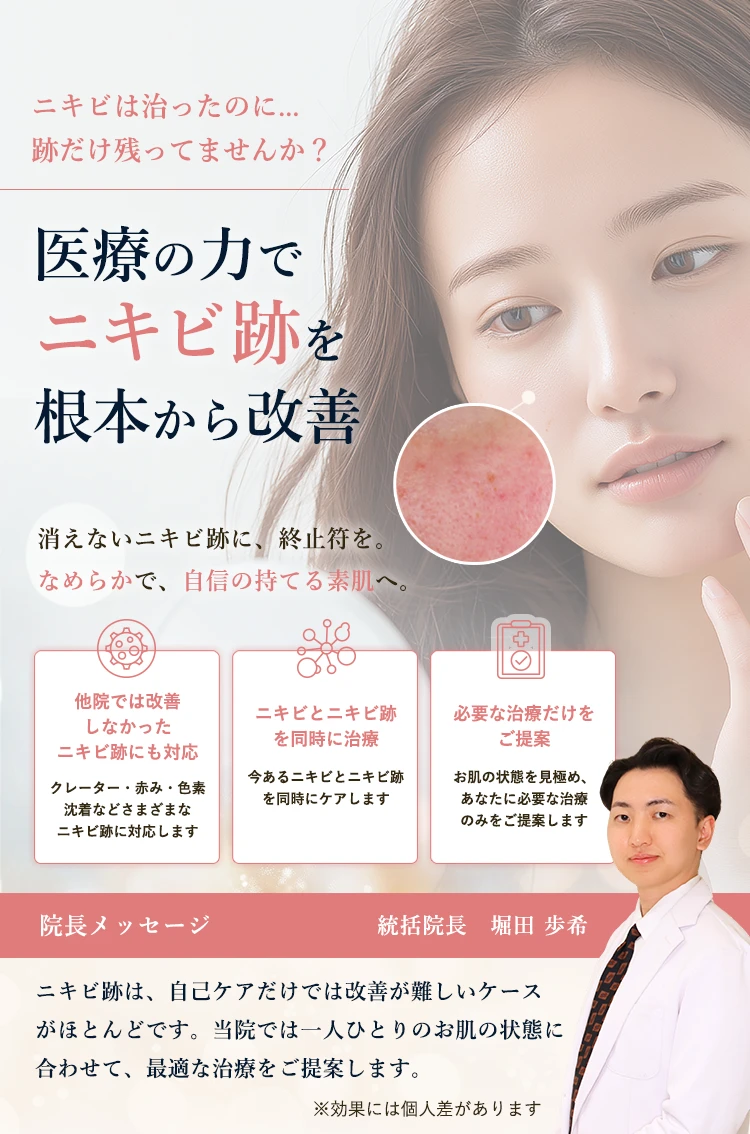 お悩み別分類  ニキビ・ニキビ跡