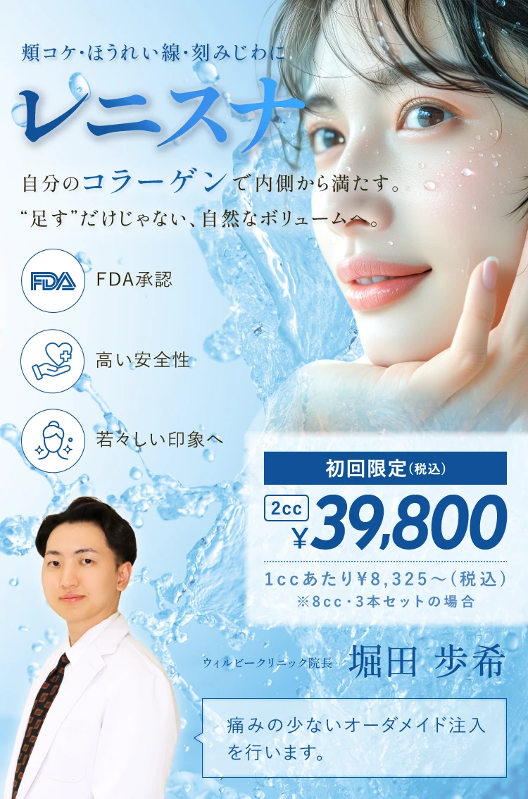 レニスナ