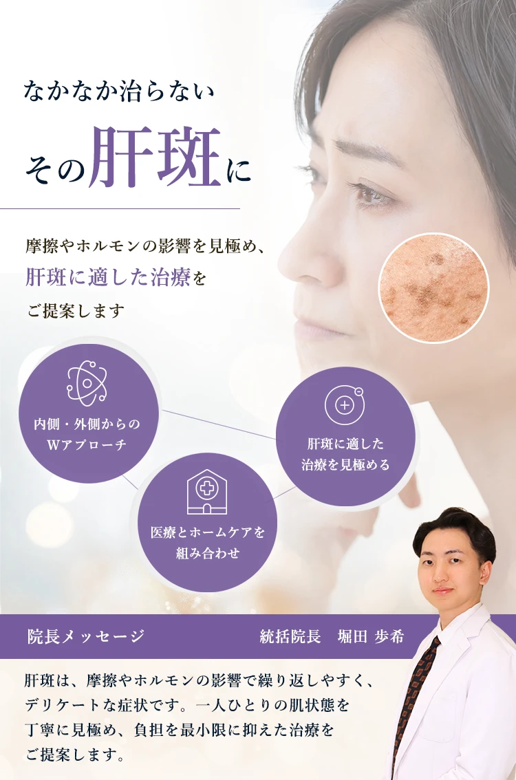 お悩み別分類  肝斑