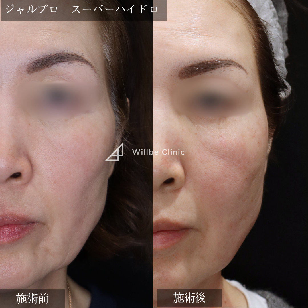 No.7465の症例写真