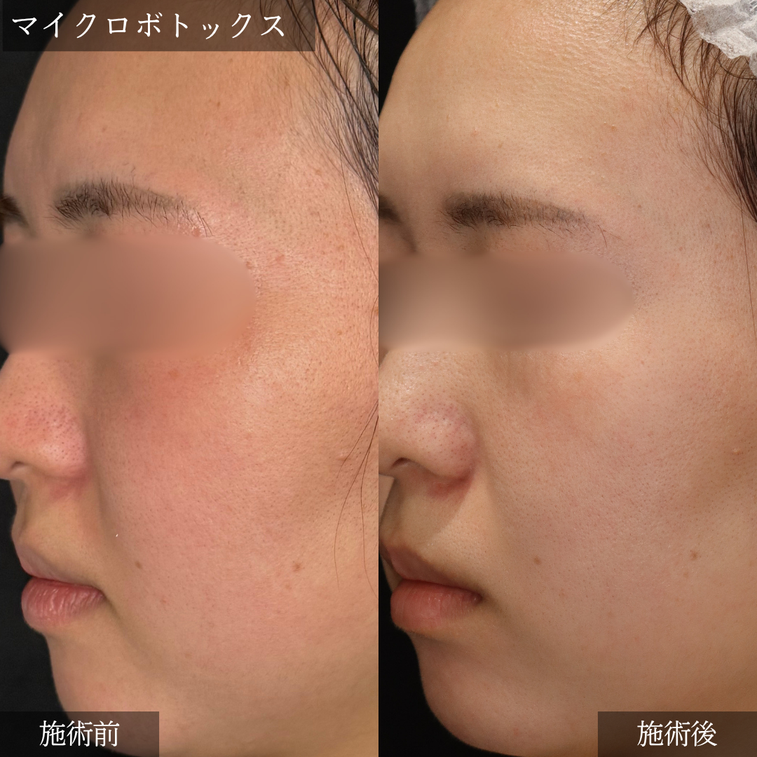 No.7478の症例写真