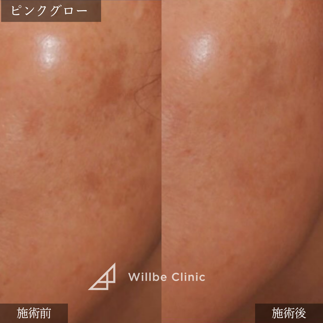 No.7498の症例写真
