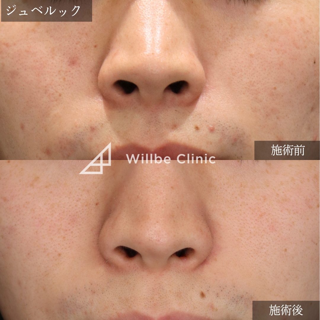 No.7486の症例写真