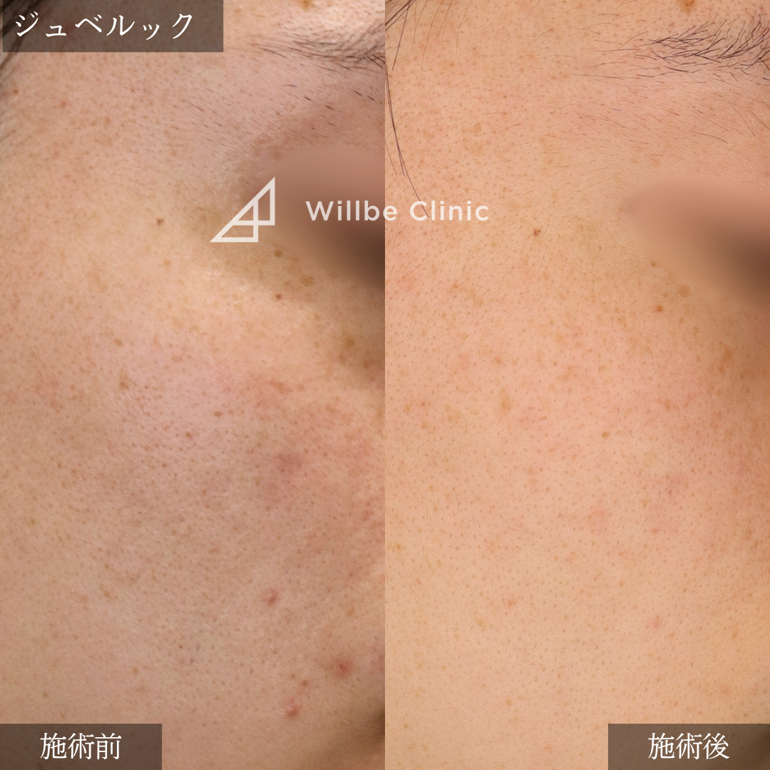 No.7491の症例写真