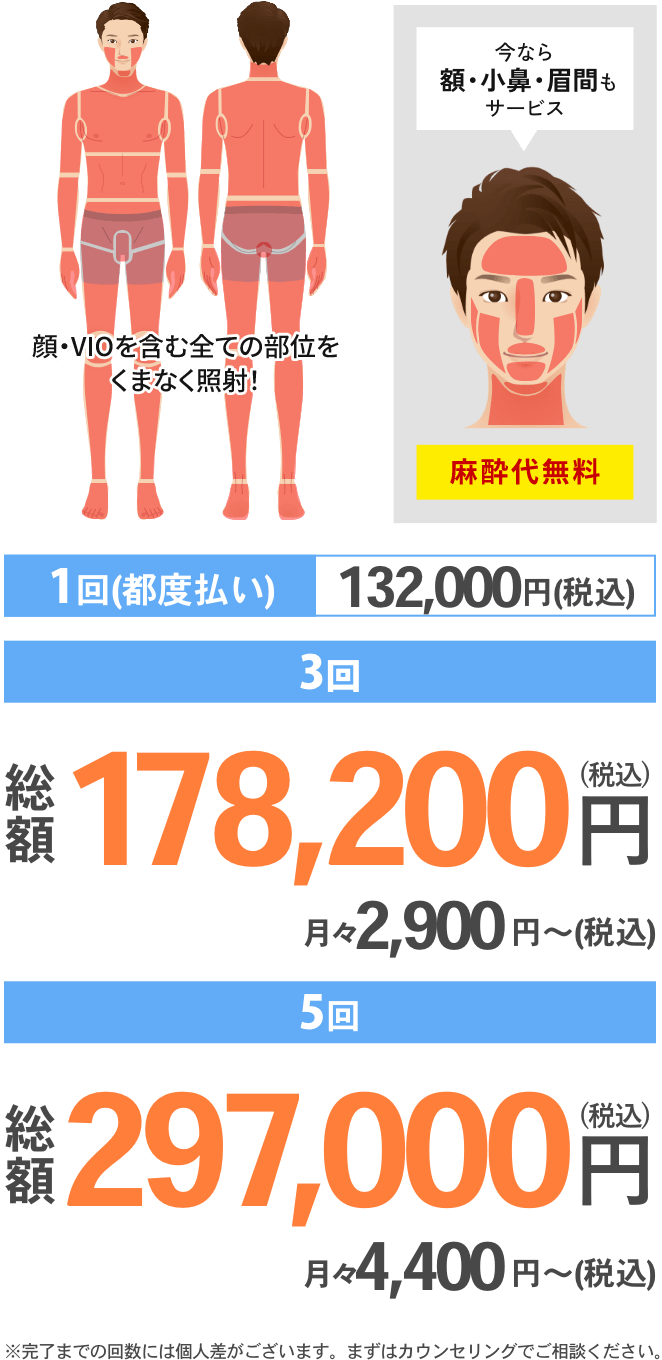 パーフェクト全身脱毛
