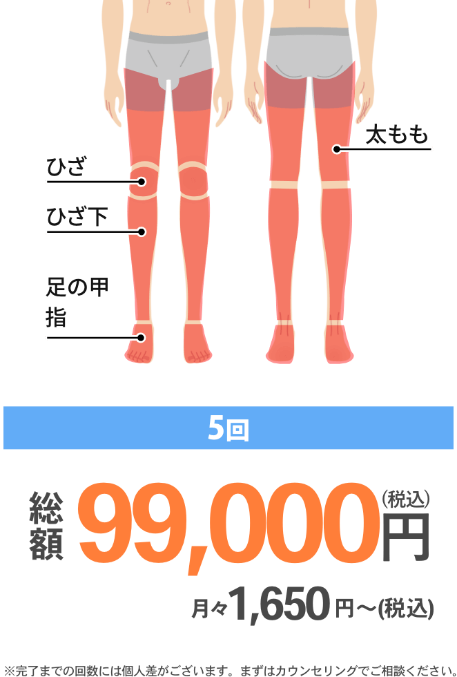 足全体脱毛