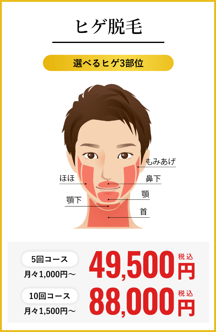 ヒゲ脱毛
