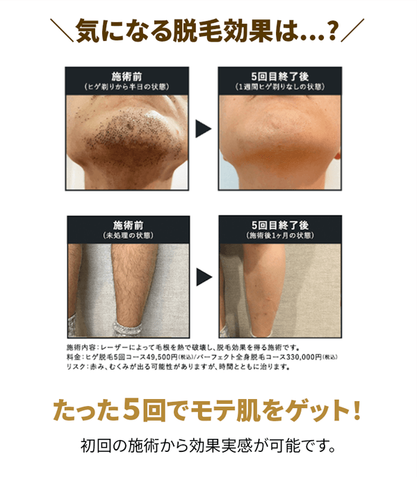 たった5回でモテ肌をゲット！