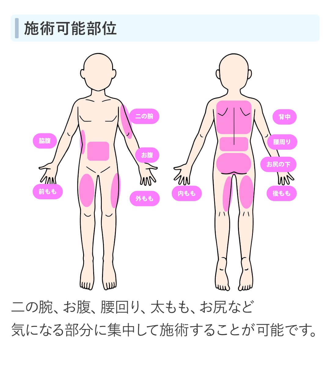 施術可能部位