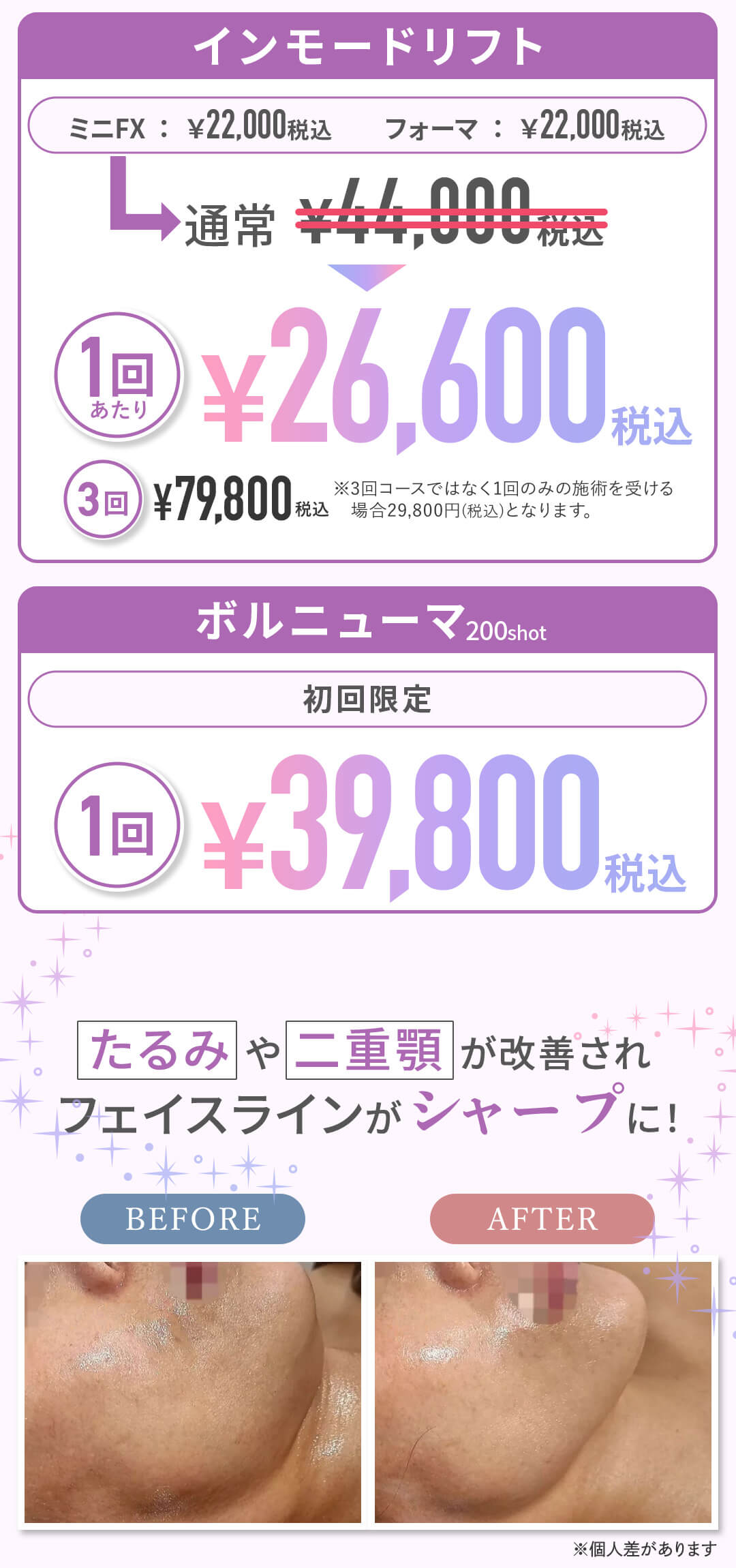 インモードリフト 1回あたり￥26,600、ボルニューマ 初回限定 1回￥39,800
