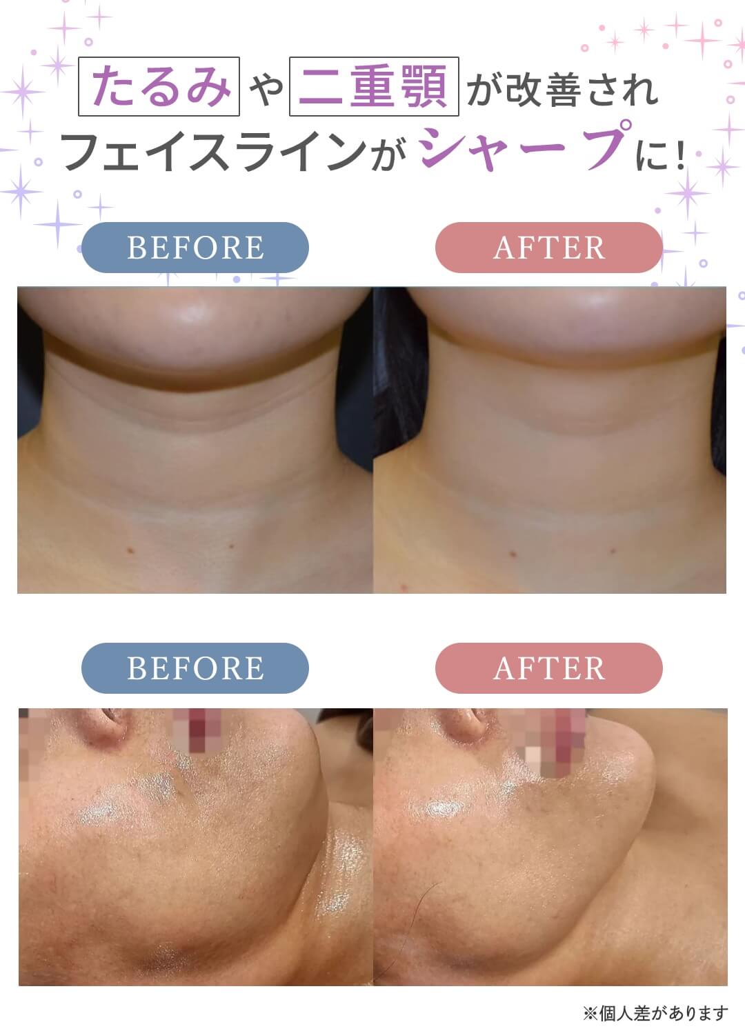 症例写真